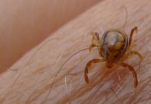 Wat doen bij een tekenbeet tekenbeet